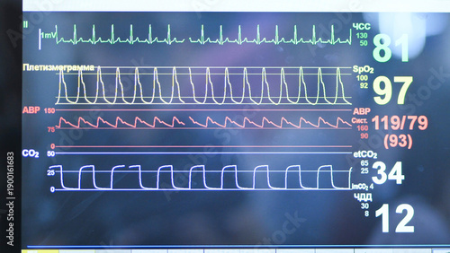 Patient vital signs monitoring on hospital medical equipment screen display