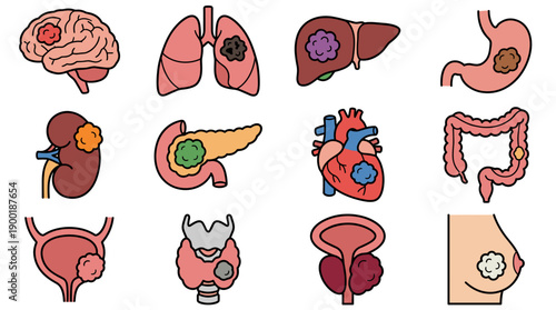 Visualizing Cancer's Impact: A Detailed Depiction of Various Human Organs Affected by Tumors and Malignant Growths for Healthcare Education, Awareness Campaigns, and Medical Illustrations