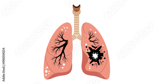 Illustration of damaged human lungs with visible black spots and lesions representing illness disease or respiratory problems set against a clean white