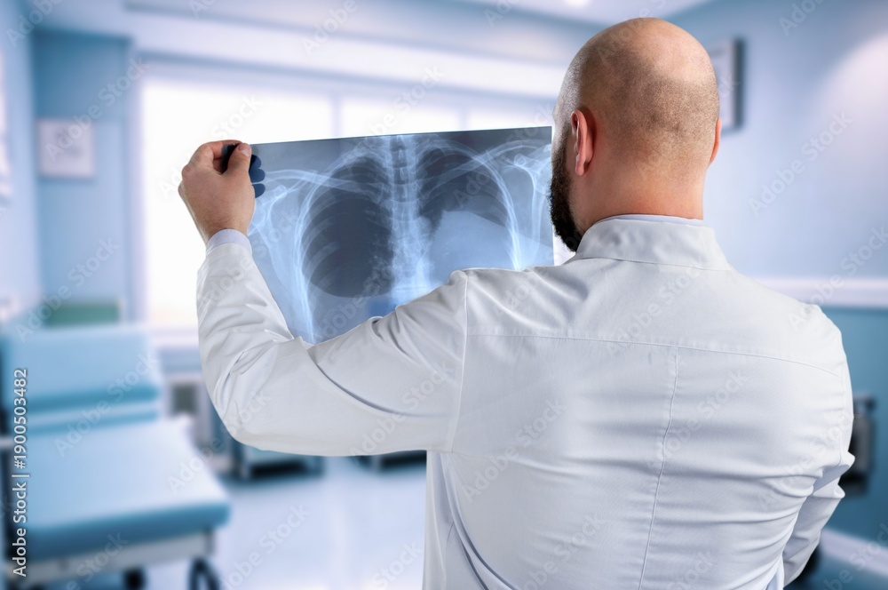 Fototapeta premium Senior doctor hold xray for thinking in clinic