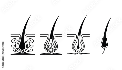 Different stages of hair follicle miniaturization icon showing thinning and eventual hair loss