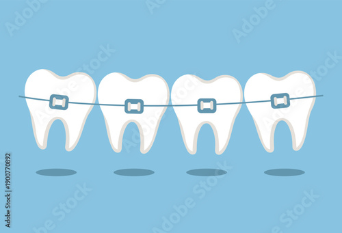 Teeth with braces on blue background. Dental braces, bracket, orthodontic, dentistry symbol. Dental care concept. Straightening of crooked bites. Vector illustration in flat style