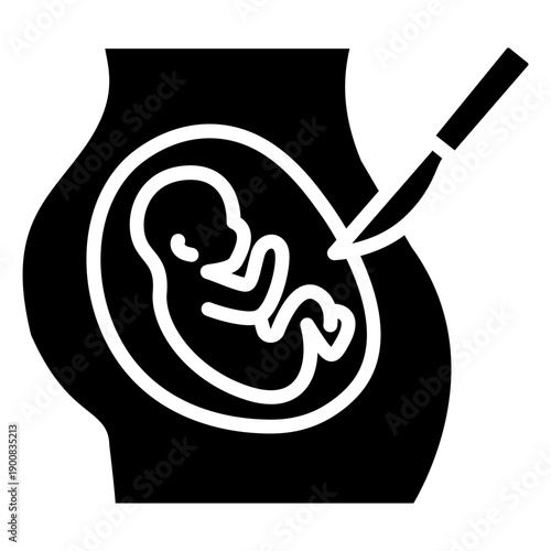 Cesarean Section Vector Icon