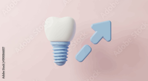 A 3D render of a white tooth implant with blue dental screw and arrows