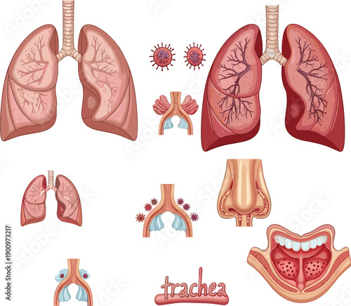 Human lungs anatomy and respiratory disease illustration set, trachea bronchi infection inflammation medical healthcare vector diagram collection