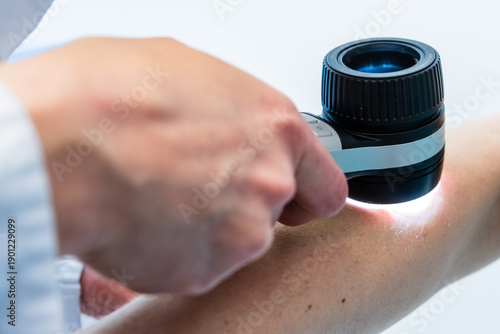 Dermatologische Untersuchung mit Dermatoskop an einem Unterarm, Düsseldorf, Deutschland