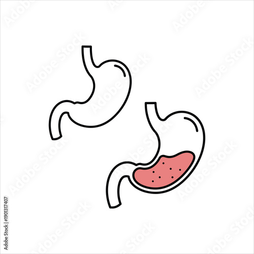 Illustration of a human stomach one empty and one with contents