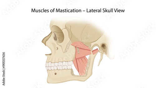Muscles of Mastication – Lateral Skull View
This illustration shows a lateral skull view highlighting key muscles of mastication including the masseter, medial pterygoid, and lateral pterygoid. 