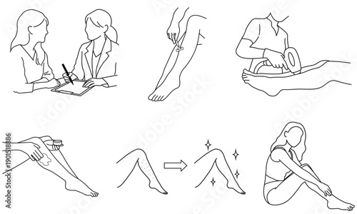 脚の脱毛工程を表した線画イラストセット
