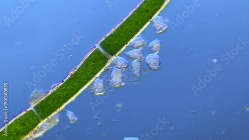 Vorticella and other microorganisms under the microscope at 100x Magnification