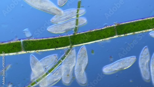 Numerous microorganisms under the microscope