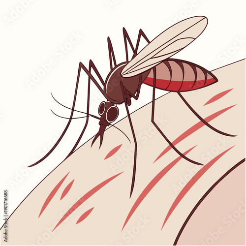 Mosquito biting human skin insect bite