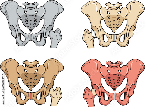 Human pelvic bone anatomy illustration, sacrum ilium ischium pubis femur structure, educational medical diagram, comparative colored skeletal art