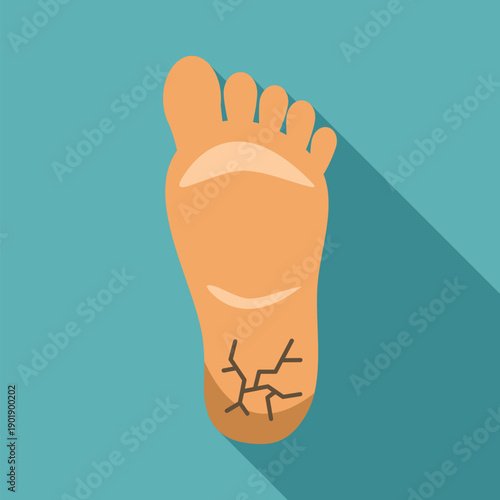 Human foot showing a cracked heel, representing dry skin and dermatology concept