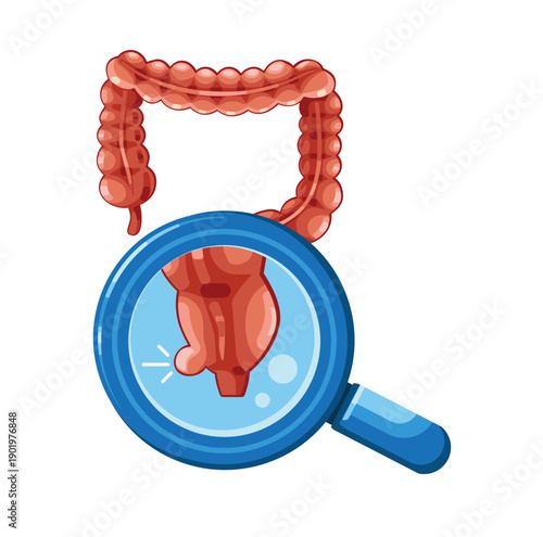 Illustration of the Human Appendix Highlighted with Magnifying Glass, Showing Large Intestine Anatomy for Medical Education.