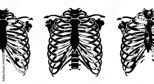 Three detailed black silhouette illustrations of human rib cages on a white background, showcasing anatomical skeletal structure.