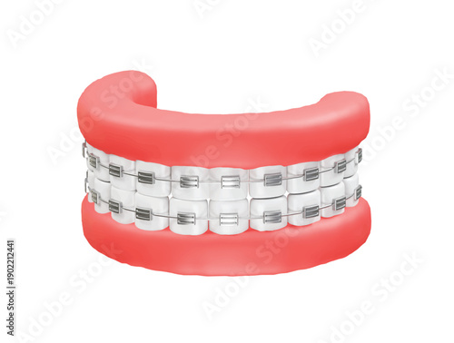 Teeth with Braces Model icon 3d rendering illustration
