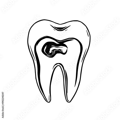 Minimalist black and white line art illustration of an infected tooth, capturing dental pain and cavity issues with a simple, clean design perfect for health, medical, and educational content