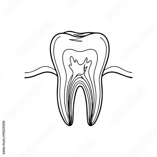 Detailed illustration of a tooth with visible root structure and gums
