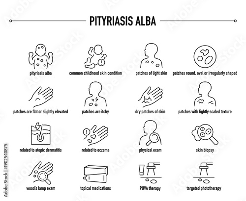 Pityriasis Alba symptoms, diagnostic and treatment vector icon set