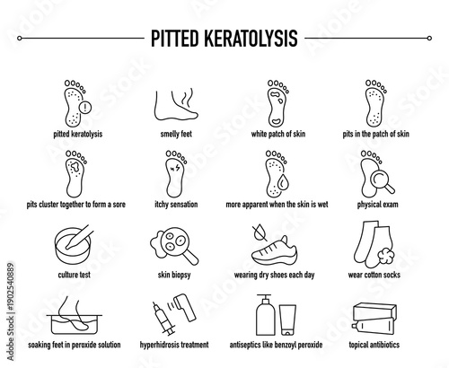 Pitted Keratolysis symptoms, diagnostic and treatment vector icon set