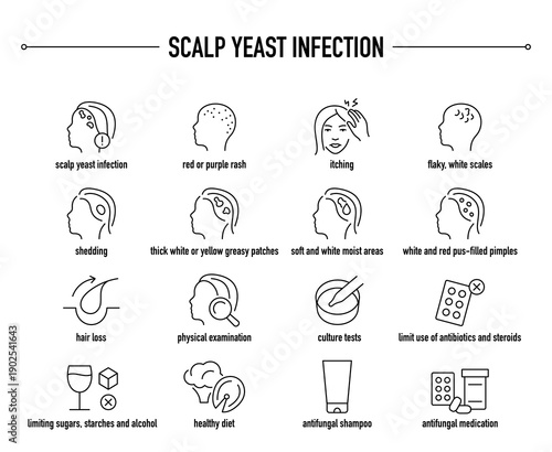 Scalp Yeast Infection symptoms, diagnostic and treatment vector icon set