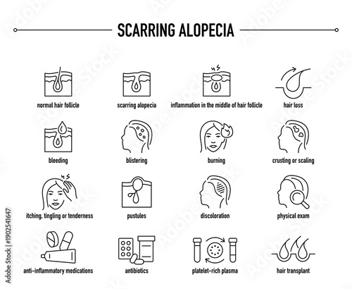 Scarring Alopecia symptoms, diagnostic and treatment vector icon set