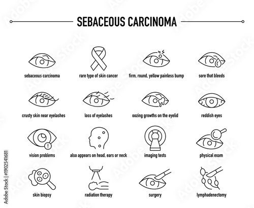 Sebaceous Carcinoma symptoms, diagnostic and treatment vector icon set