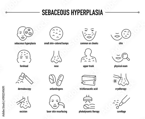 Sebaceous Hyperplasia symptoms, diagnostic and treatment vector icon set