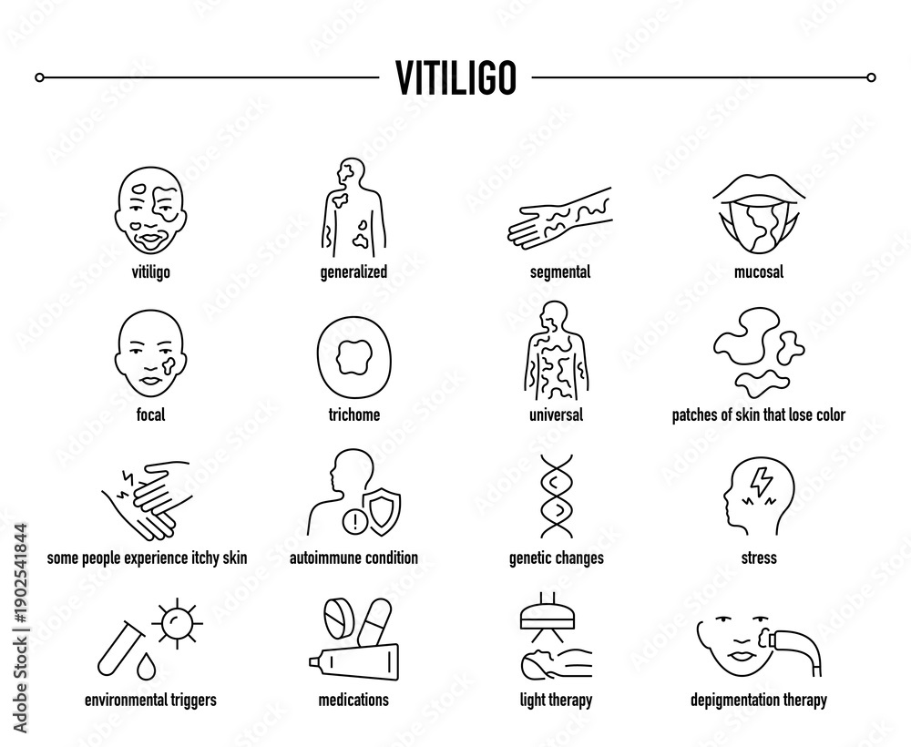 Fototapeta premium Vitiligo symptoms, diagnostic and treatment vector icon set