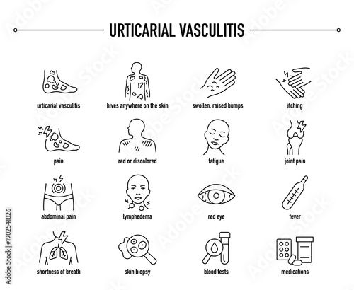 Urticarial Vasculitis symptoms, diagnostic and treatment vector icon set