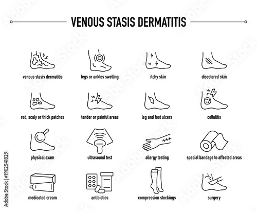 Venous Stasis Dermatitis symptoms, diagnostic and treatment vector icon set