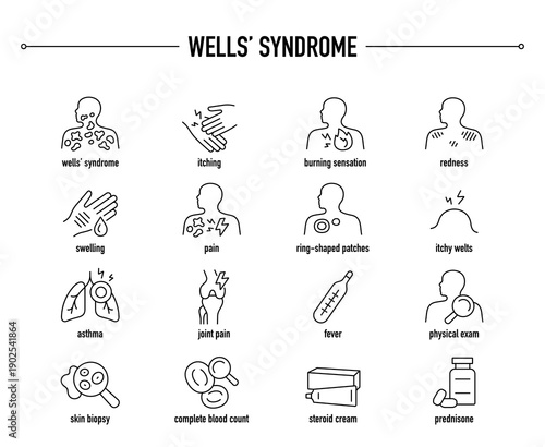 Wells’ Syndrome symptoms, diagnostic and treatment vector icon set