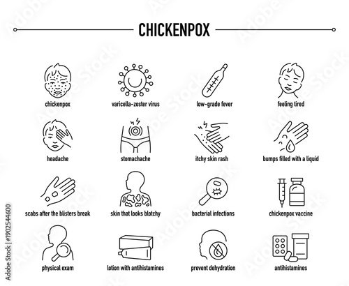 Chickenpox symptoms, diagnostic and treatment vector icon set