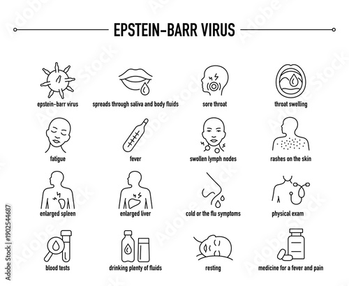 Epstein-Barr Virus symptoms, diagnostic and treatment vector icon set
