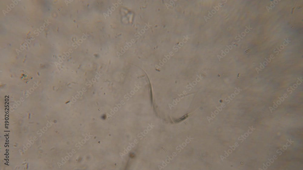 Bacteria Parasites and Worms in drinking Water under Microscope ...