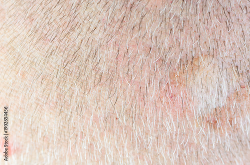 Wallpaper Mural Close-up macro view of aging scalp with sparse gray and dark hair and visible skin texture Torontodigital.ca