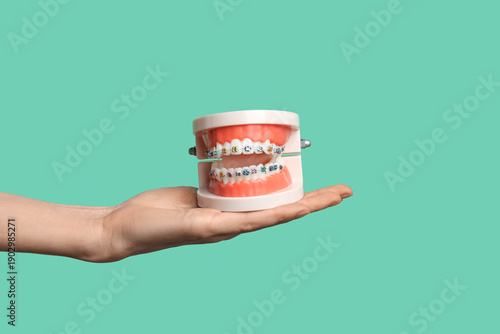 Female hand holding model of jaw with dental braces on green background