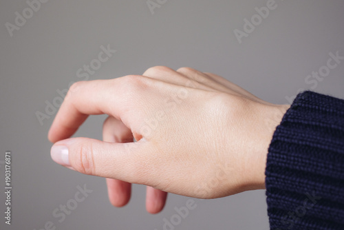 Female right back hand with ganglion cyst on the dorsum,  fluid-filled bump associated with a joint or tendon sheath, close-up view, selected focus.
