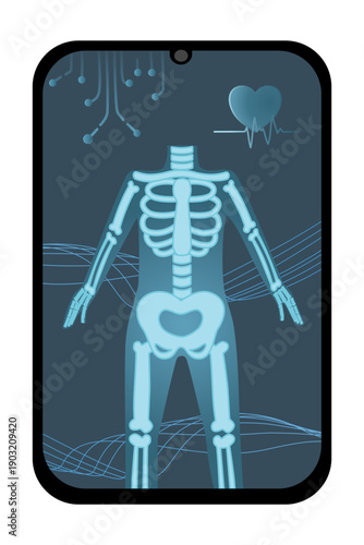 Medical X-Ray Skeleton Vector Illustration on Smartphone Screen for Healthcare App Interface and Digital Diagnostic Concept