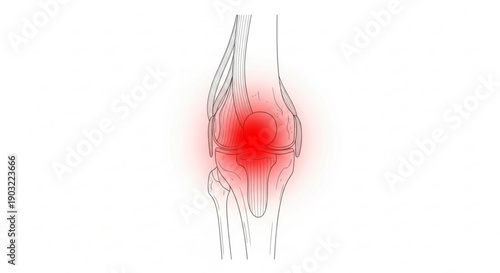 Knee pain illustration with red highlighted area