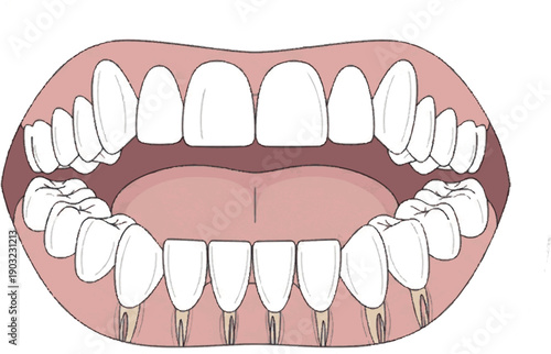 Detailed illustration showcasing the anatomy of healthy human teeth and the precise placement of dental implants in the lower jaw, emphasizing modern dentistry procedures and oral health