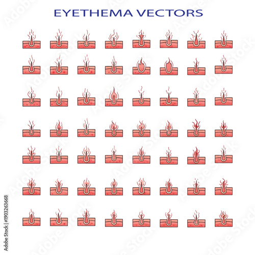Erythema Skin Condition Concept Showing Red Inflamed Irritated Human Skin