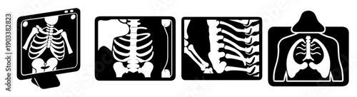 Medical chest x-ray scans in black and white frames for healthcare diagnosis and analysis