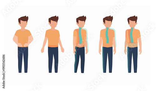 Spinal posture comparison of young man with kyphosis lordosis flat back vector illustration