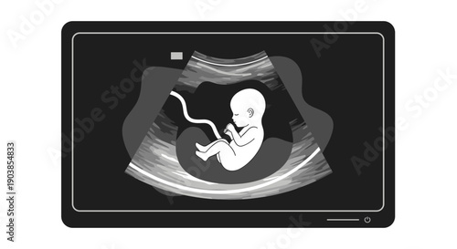 Ultrasound scan of a human fetus on a medical monitor screen, a monochrome vector illustration showing prenatal development and diagnostics, isolated on white background