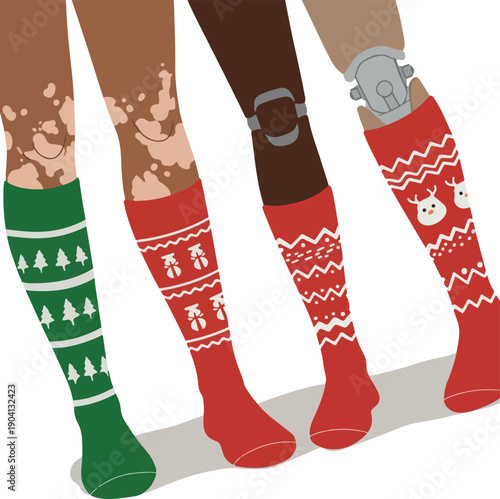 Diverse Legs Christmas Socks Including Prosthetic and Vitiligo