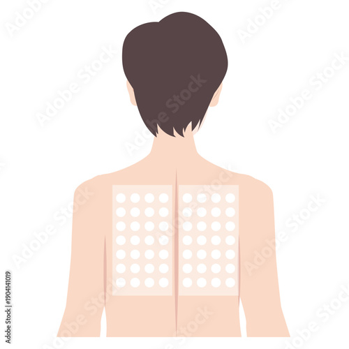 背中のパッチテスト