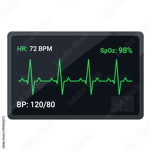 ECG monitor screen showing heart rate, blood pressure, and oxygen saturation