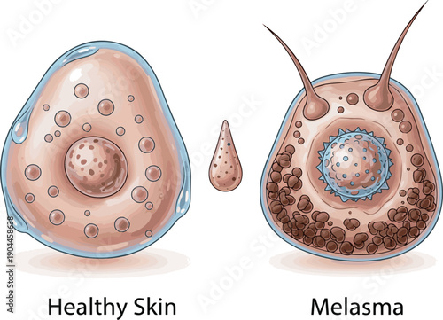 Isolated a realistic Comparation of healthy skin and melasma on skin cell. Skin treatment product. 3D rendering. vector art with white background.